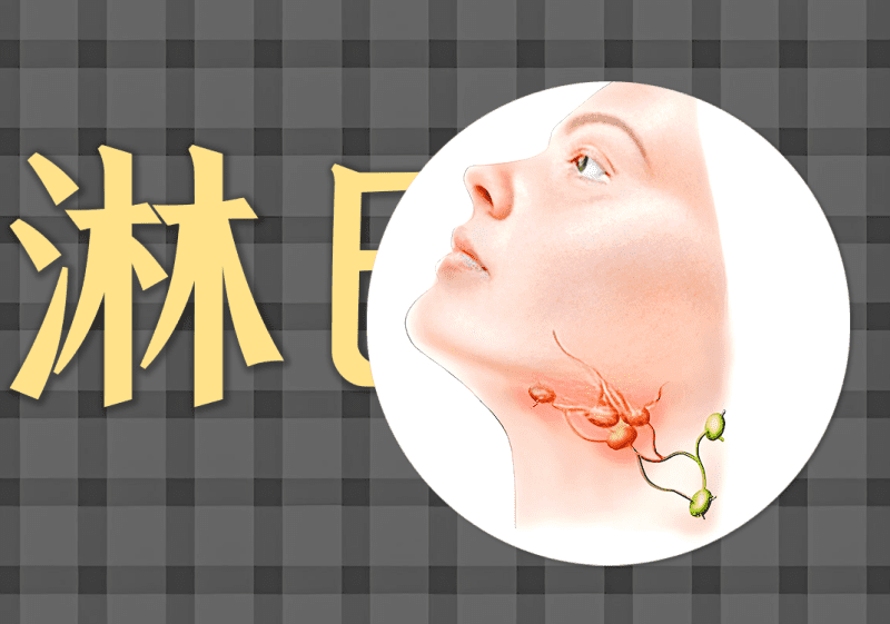 脐针:淋巴结瘤病例-善米