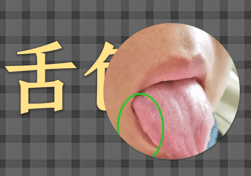 舌诊之色的阴阳之道-善米