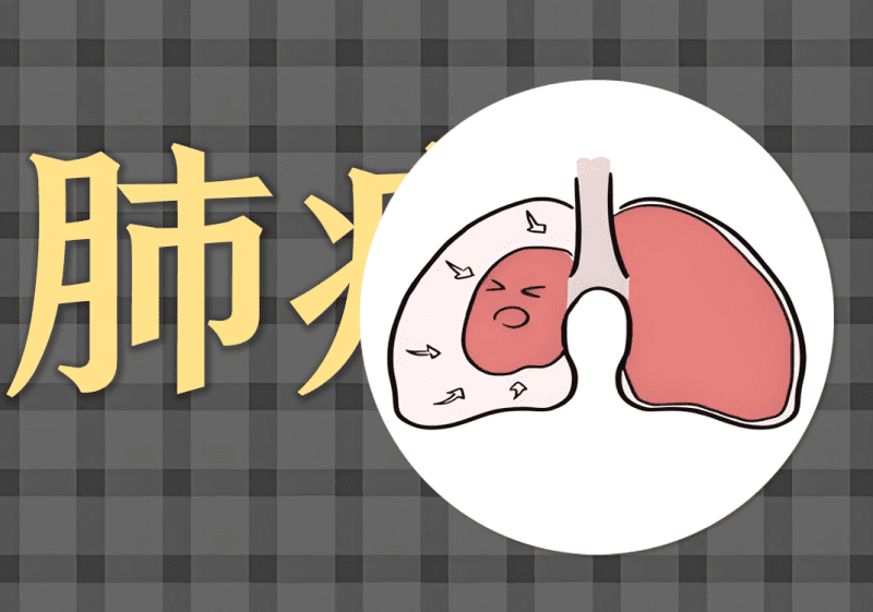 小药粉：肺区胀疼-善米